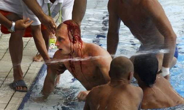 Bielorusso erra salto e sofre corte feio na cabeça