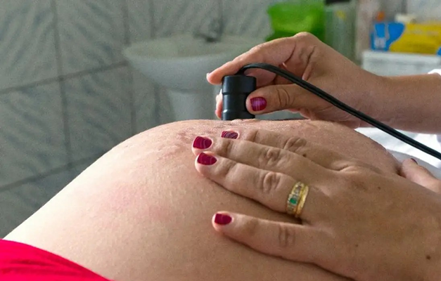Assistência ao parto avança no Brasil, mas pré-natal ainda preocupa