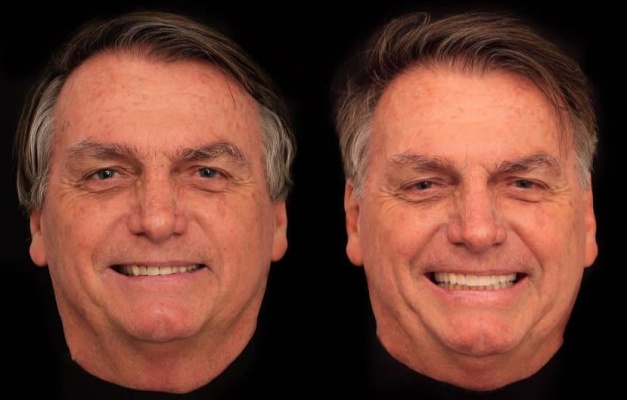 Bolsonaro realiza harmonização e coloca lente nos dentes em Goiânia