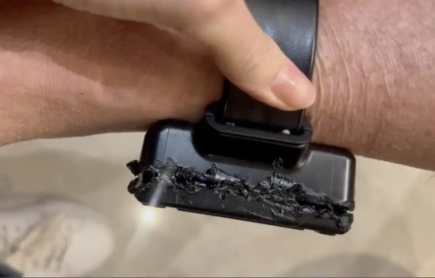 Bolsonaro usou ferro de solda para tentar abrir tornozeleira