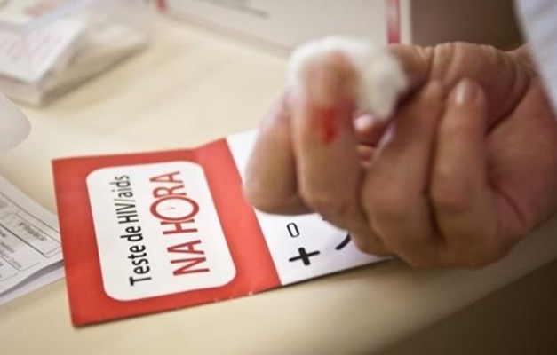 Brasil registra queda significativa em mortes por HIV, diz revista