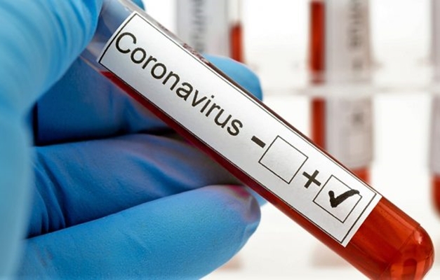 Covid-19: Goiás registra 1,3 mil infectados em 24h e chega a 230 mil casos