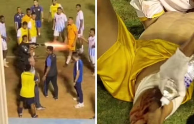 Goleiro baleado por policial militar em Anápolis ficará 4 meses sem jogar
