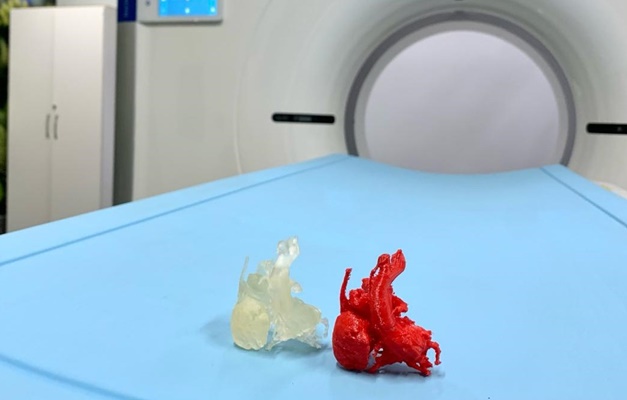 Hugol e UFG realizam primeira impressão 3D de coração em Goiás