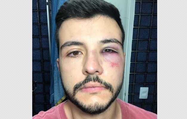 Jornalista Matheus Ribeiro é agredido durante tentativa de assalto