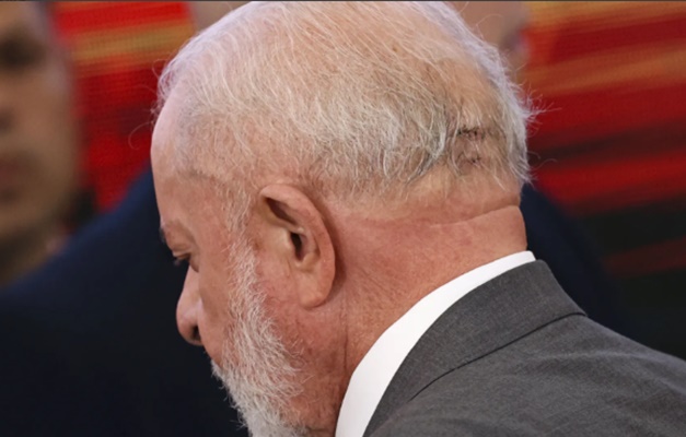 Lula tira pontos da cabeça nove dias depois de acidente