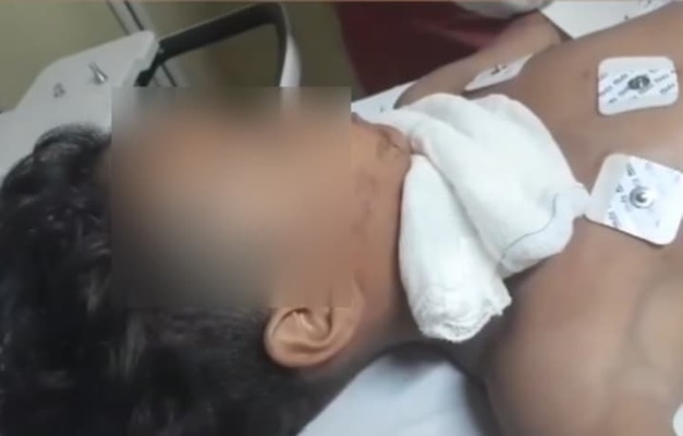 Menino tem pescoço cortado por linha com cerol em Anápolis