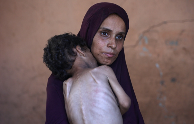 Mortes por inanição se espalham pela Faixa de Gaza e pressão por cessar-fogo aumenta