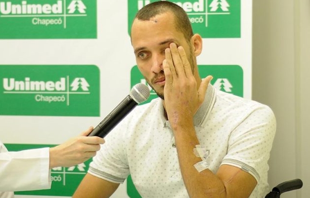 Neto quer voltar a jogar pela Chapecoense