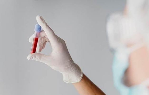 Novo exame de sangue permite diagnóstico precoce do Alzheimer 