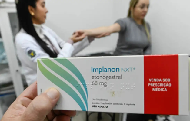 Oferta de Implante contraceptivo por planos de saúde já é obrigatória  