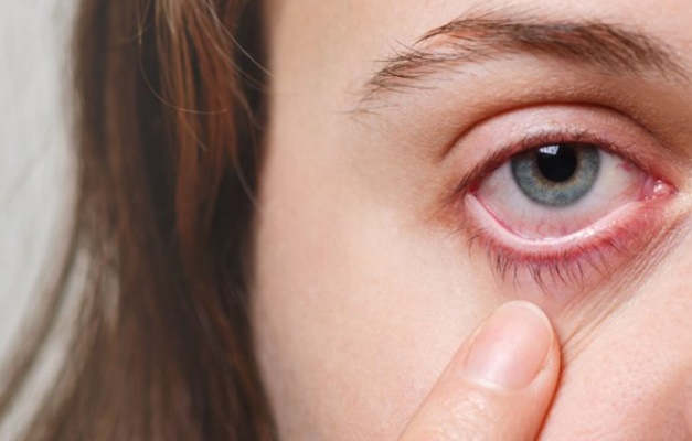 Oftalmologista alerta para doenças oculares no período de seca