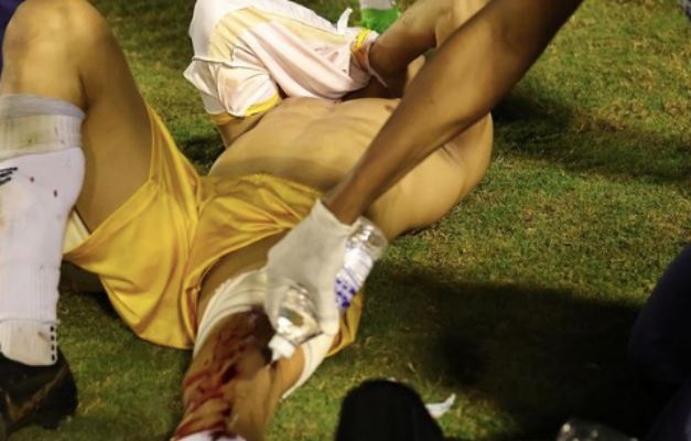 PM que atirou em goleiro do Grêmio Anápolis é afastado de ações nos estádios