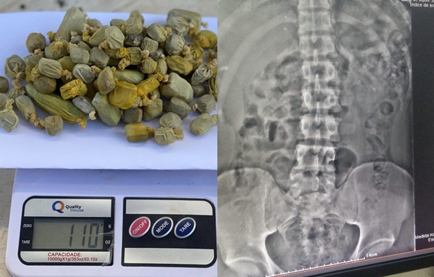 Preso com droga no estômago em Formosa planejava vender maconha na cadeia