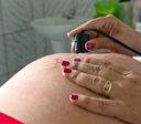 Assistência ao parto avança no Brasil, mas pré-natal ainda preocupa