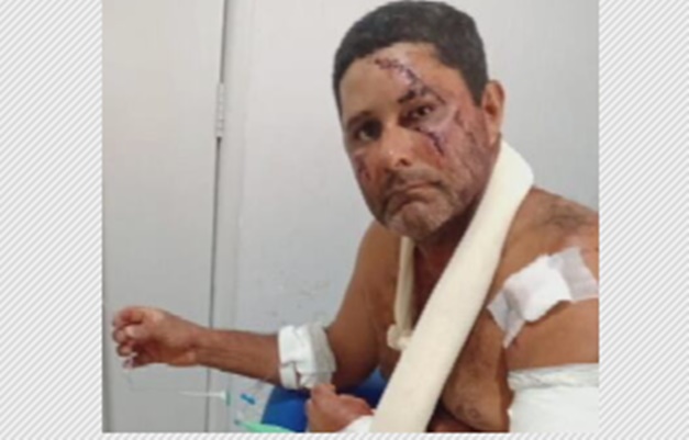 Vaqueiro é atacado por onça-pintada em Goiás, se defende com facão e sobrevive